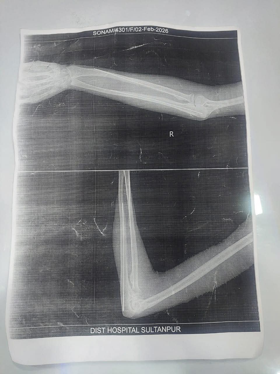 UP: सुलतानपुर मेडिकल कॉलेज का कारनामा, ‘फिल्म’ की जगह कागज पर दे रहे X-Ray; क्या यही है सरकार का हाईटेक मेडिकल मॉडल?